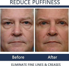 Men Eye Cream Anti Aging