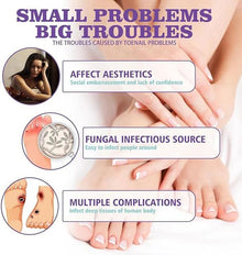 Nail Fungus Spray