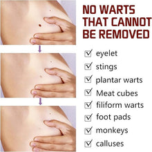 tags and moles remover
